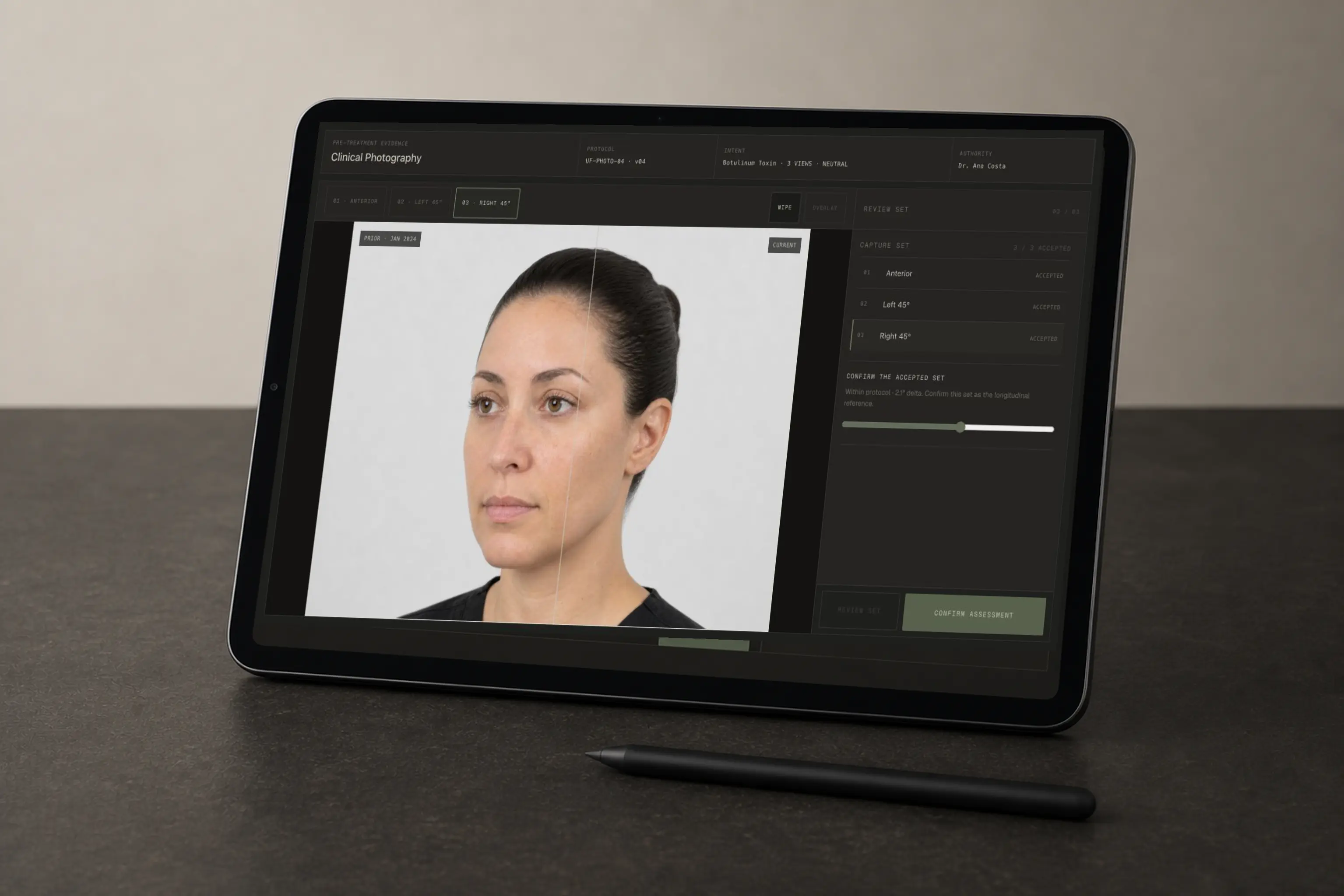 Encounter Workspace Clinical Photography review on a physical iPad Pro